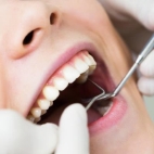 Root Canal Treatment in Turkey