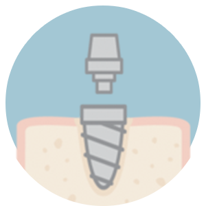 smile makeover in Turkey