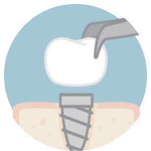 smile makeover in Turkey